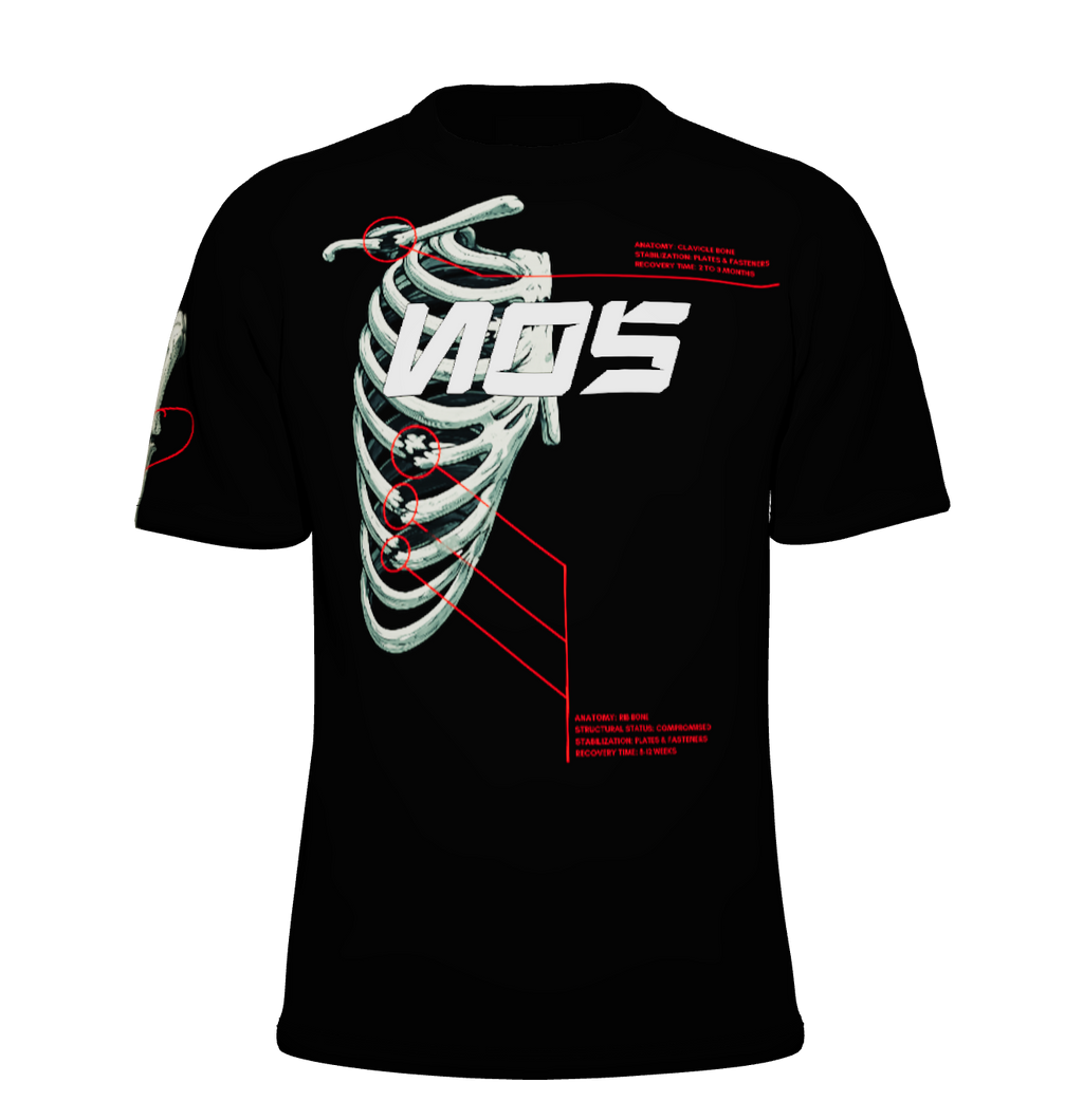 NOS Broken Bones Tshirt