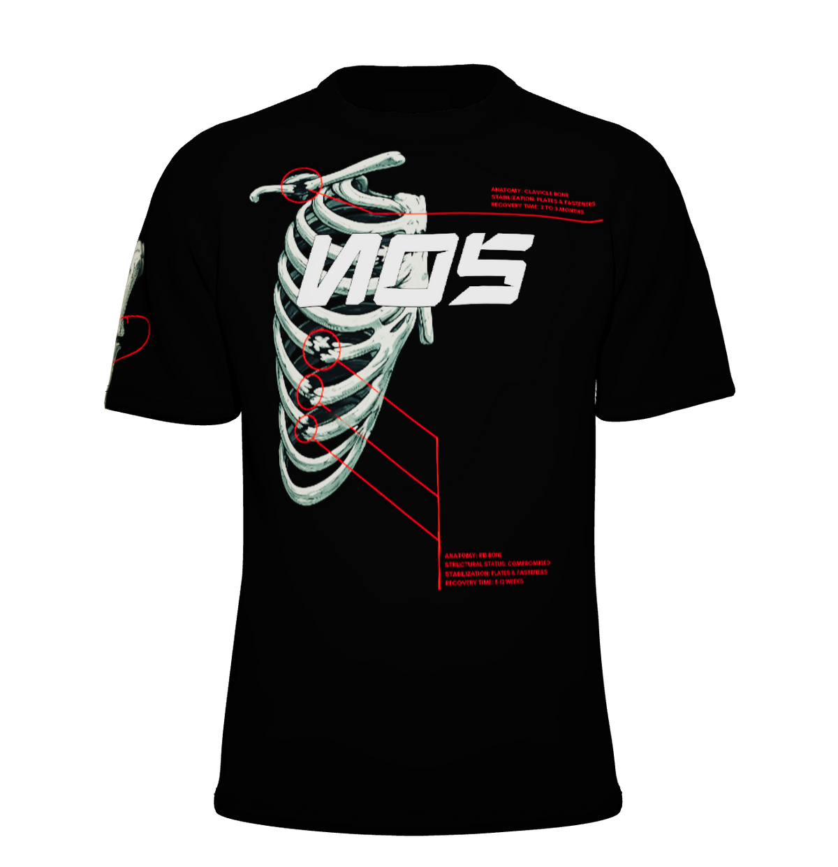 NOS Broken Bones Tshirt