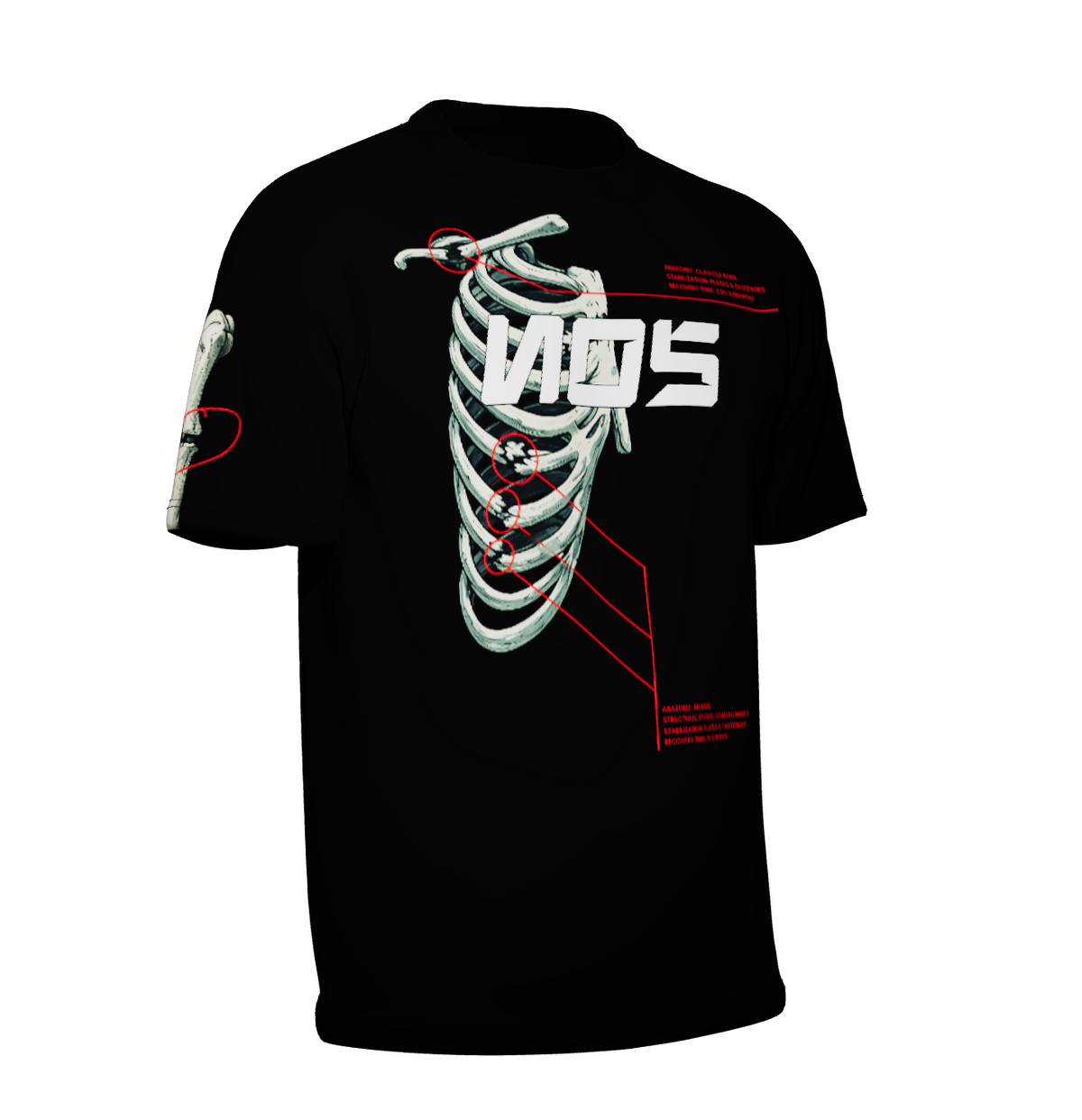 NOS Broken Bones Tshirt