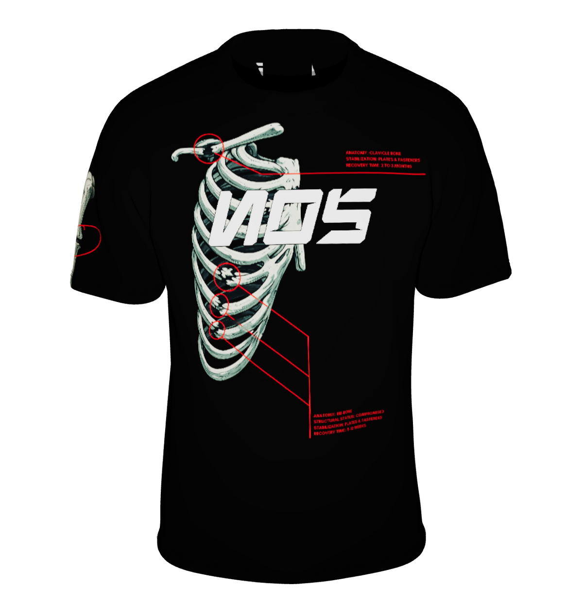 NOS Broken Bones Tshirt